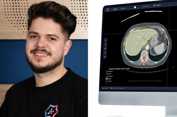 VIDEO. O echipă de tineri din Cluj redefinesc tratamentul oncologic cu o soluție revoluționară de inteligență artificială.